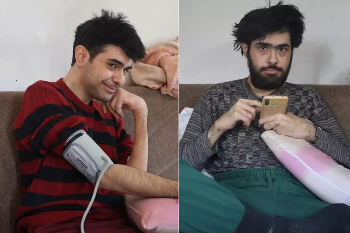 3 yil sonra dus alip tiras olan barisa teshis koyuldu B8nY6QH4.jpg