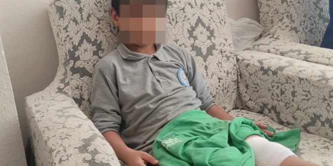 okul yolunda basibos kopegin saldirisina ugradi 6TXSSrl3.jpg